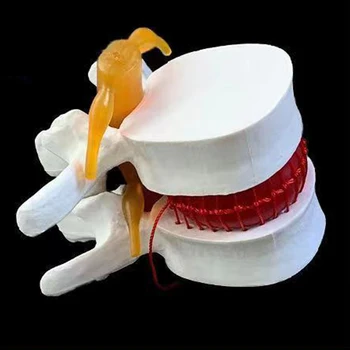 2 Вида здравно подпори Модел на анатомични отдел на гръбначния стълб, анатомия херния на лумбалните диск, набор от медицински учебни инструменти, аксесоари за училищна употреба